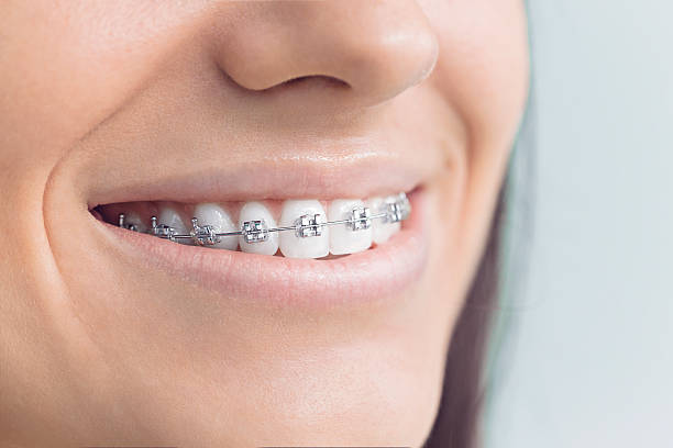Advanced Technology for Better Dental Care in Opelousas, LA